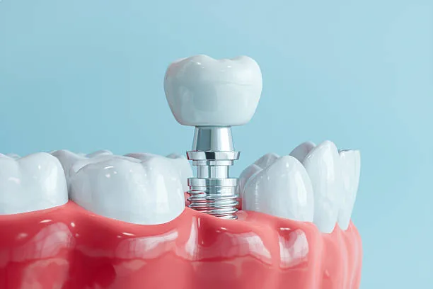 RA Dental Studio photo 3