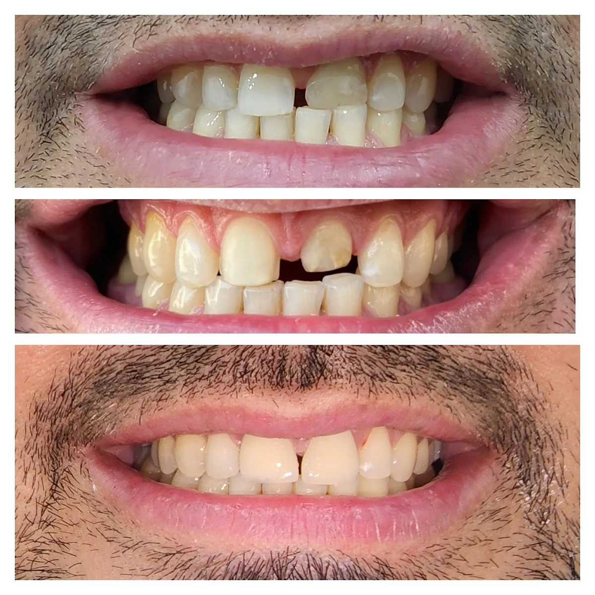 Ilham Dental Clinic Dubai Marina Diamond 3