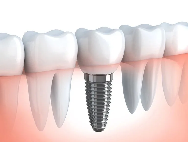 Rockwest Dental Clinic Mississauga photo 3