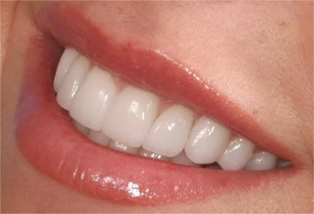 Dubai Smile Dental Clinic photo 5