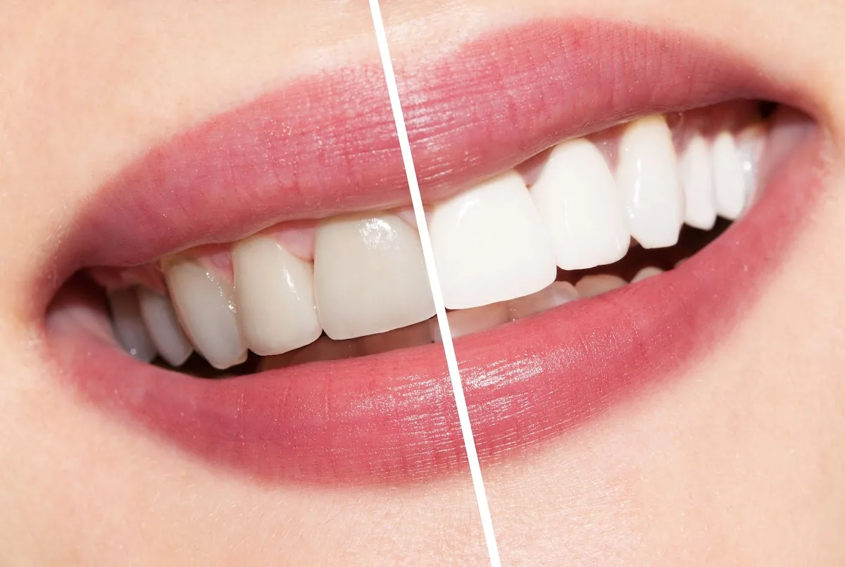 Dr. Rafih Khoury Dental Clinic photo 6