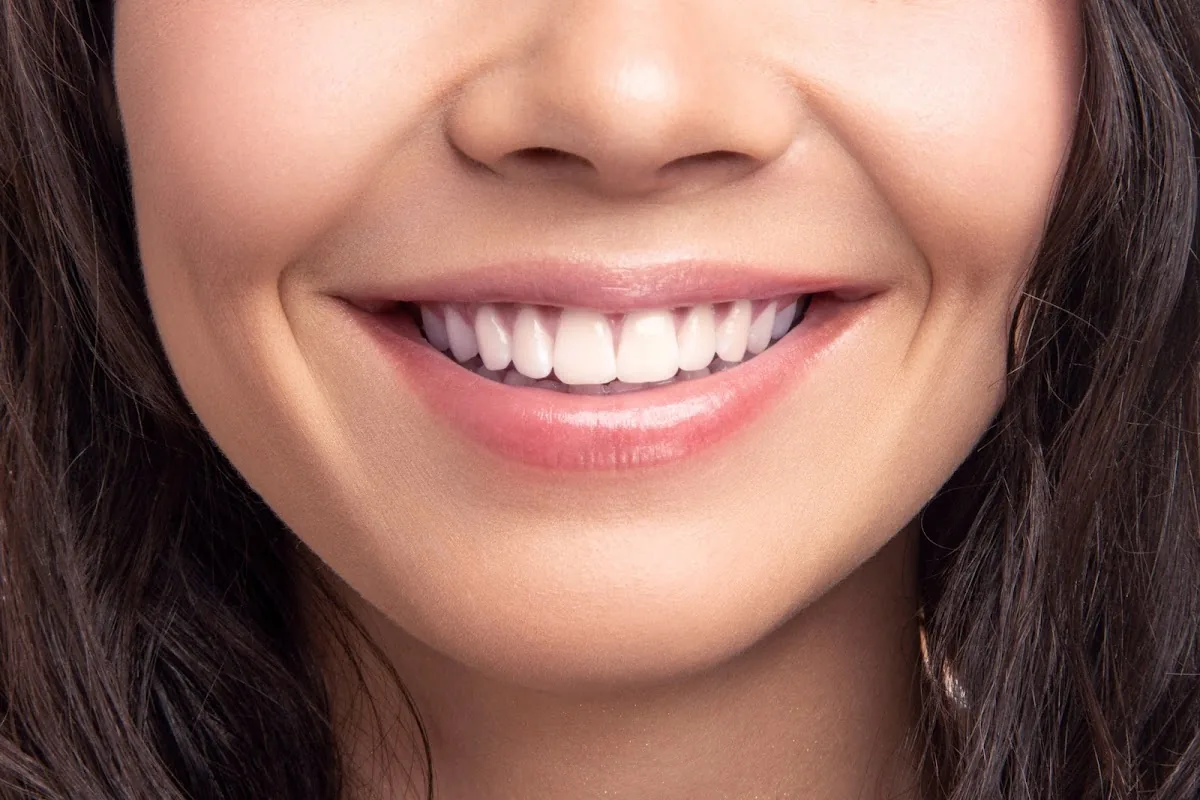 Versailles Dental Clinic - Dental Clinic in Dubai photo 3