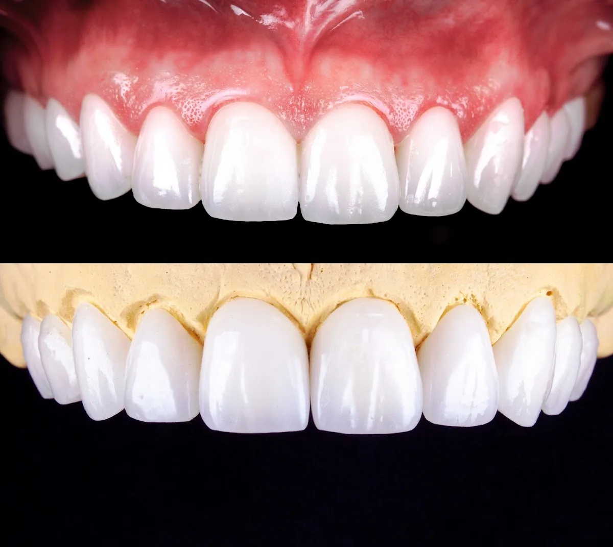 Versailles Dental Clinic - Dental Clinic in Dubai photo 4
