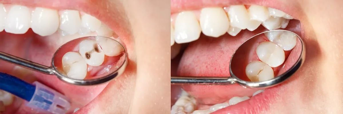 Versailles Dental Clinic - Dental Clinic in Dubai photo 5