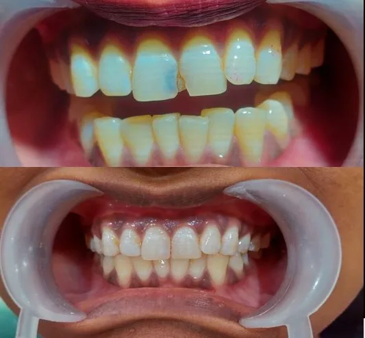 First Care Dental Associates photo 5
