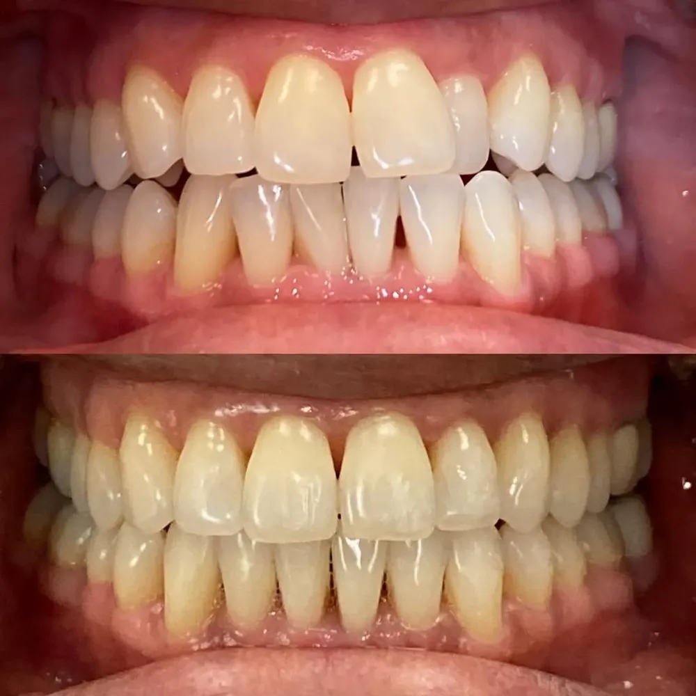 Legacy Dental Pasadena photo 2