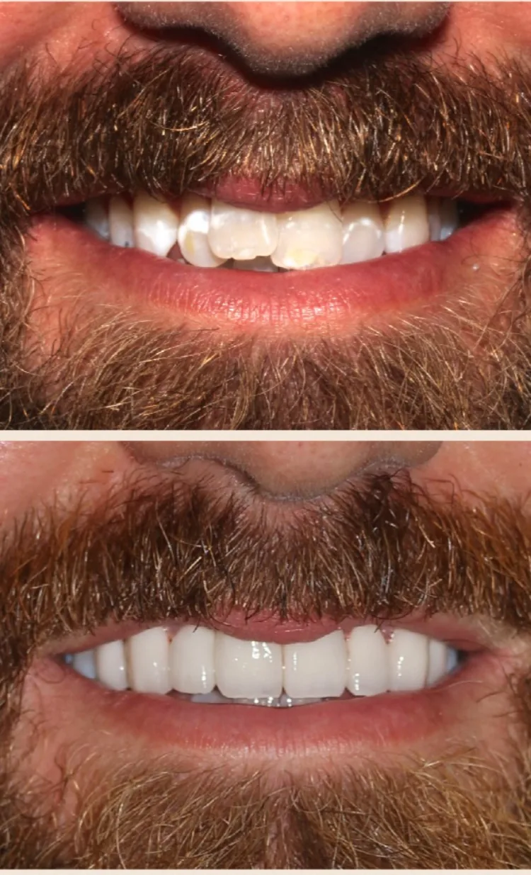 StoneCreek Dental Care - Birmingham Montclair