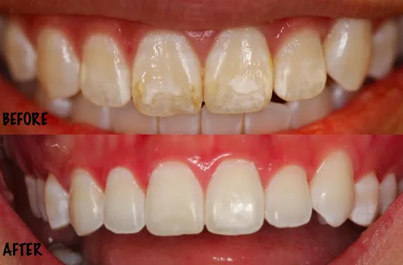 StoneCreek Dental Care - Birmingham Montclair photo 2