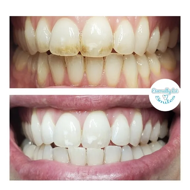 Eternally Lit Smiles llc photo 1