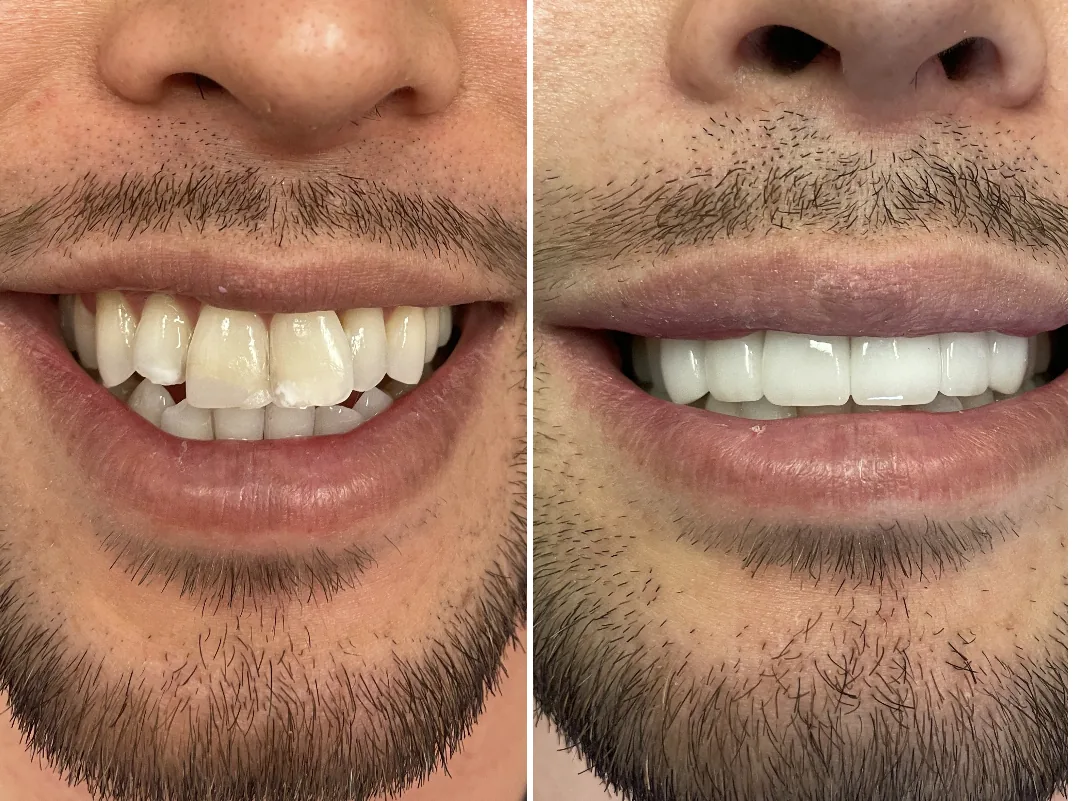 Glisten Dental Glendale photo 3