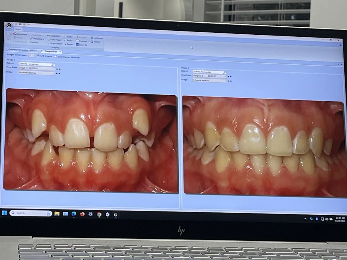 GO Orthodontics Tampa photo 2