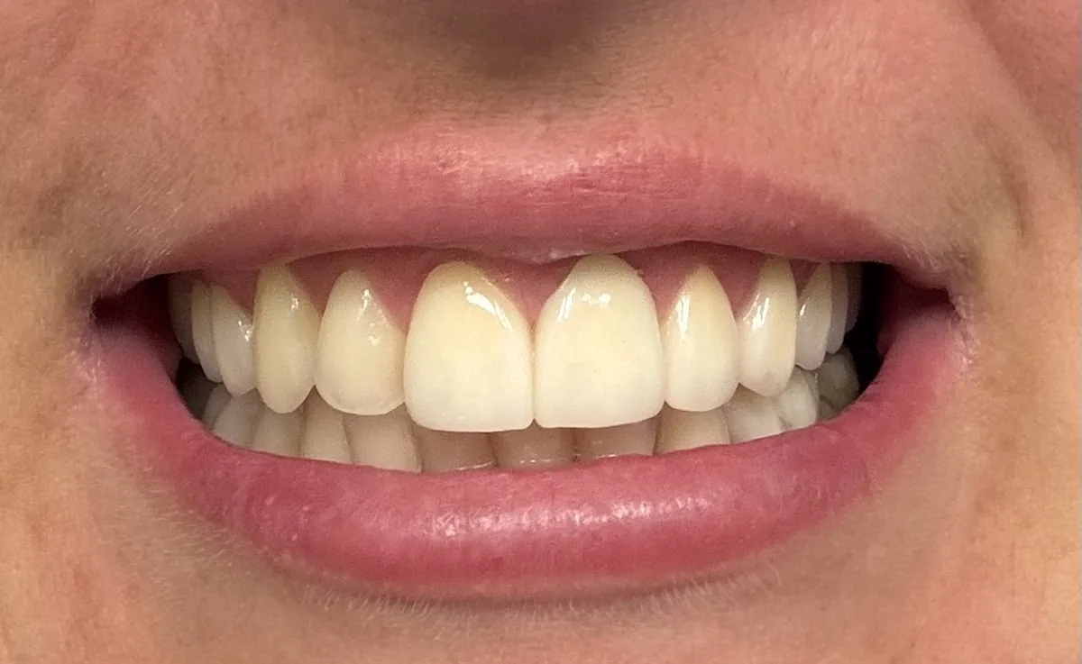 Prosthodontics and Implant Therapy Tampa photo 3