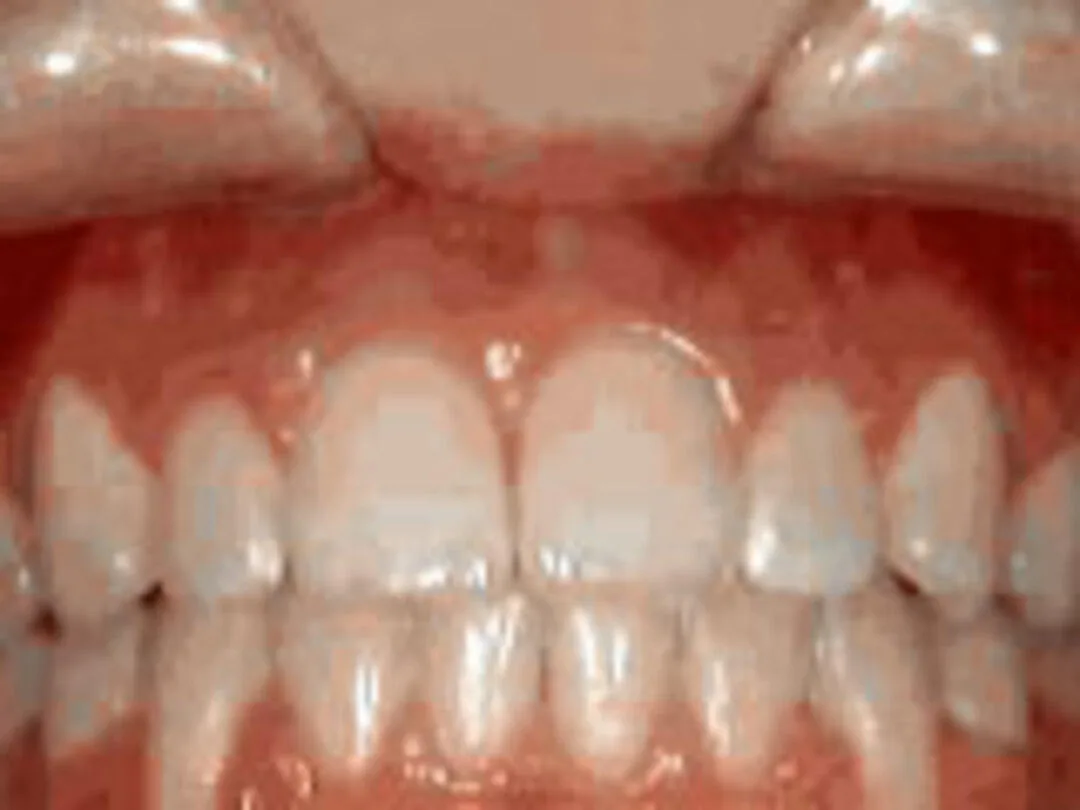 Marsh Orthodontics - William F Marsh DDS