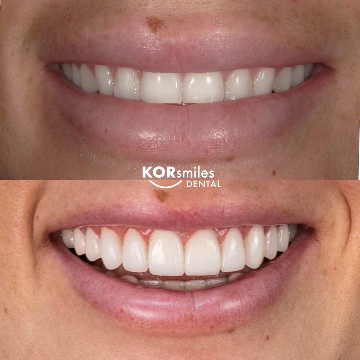 KORsmiles Dental photo 2
