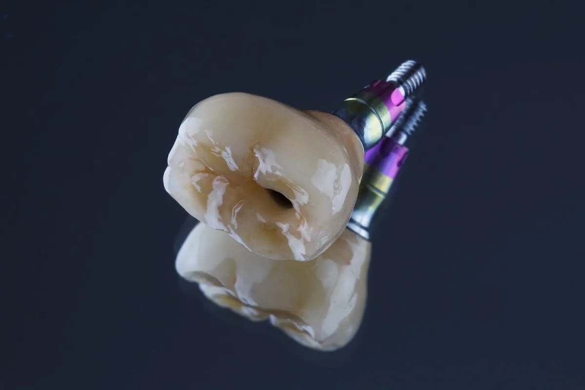 Arizona 3D Dental Lab, LLC photo 3