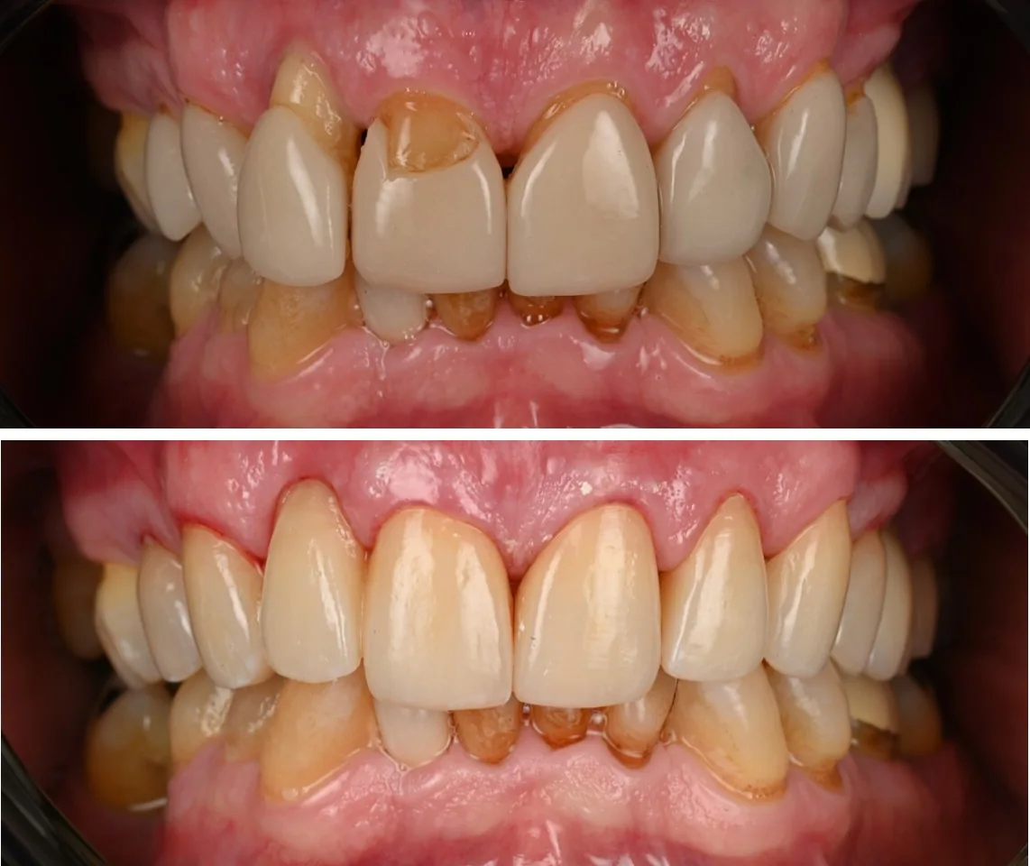 Southern California Implant Centers - Dental Implants Los Angeles- Periodontist Los Angeles, CA photo 2
