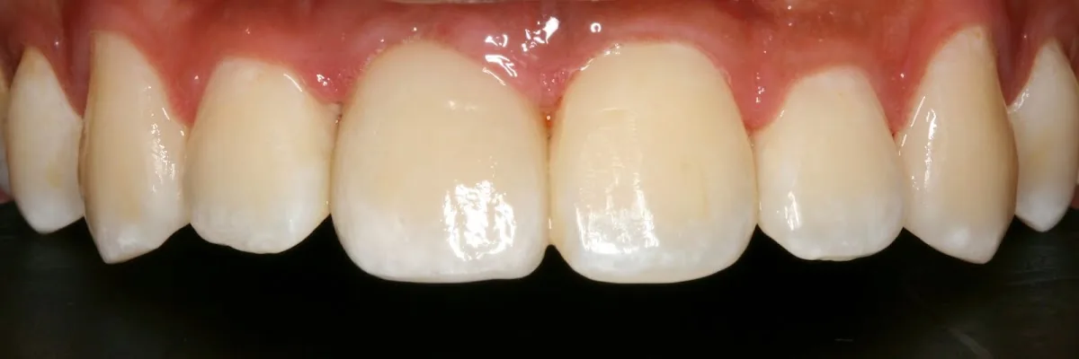 Oak Park Prosthodontics photo 3