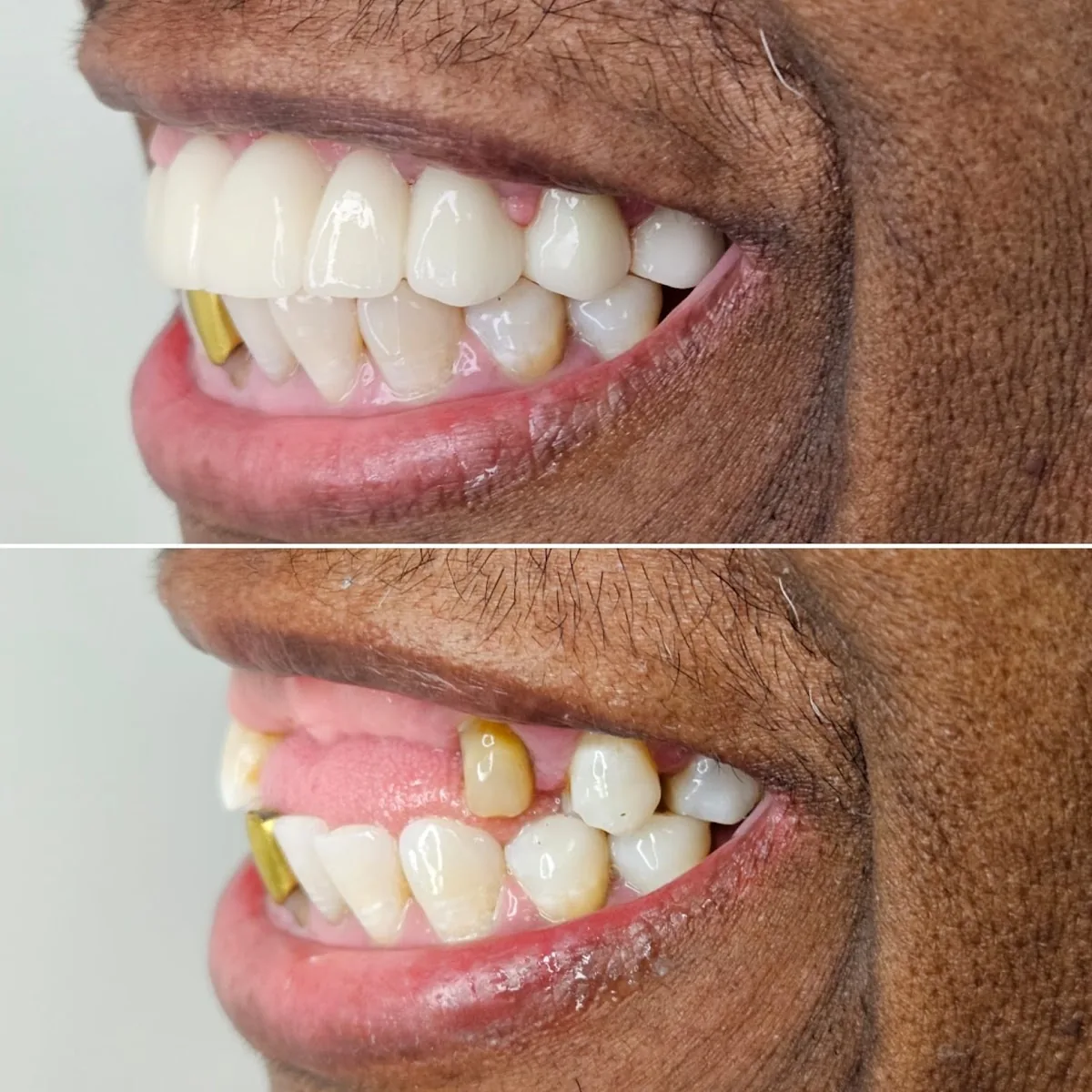 Alfonso Dental Miami photo 2