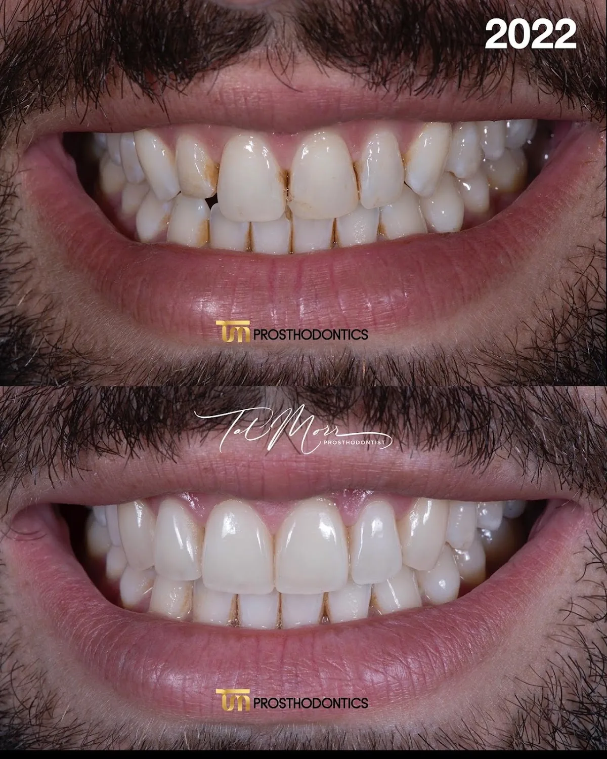 TM Prosthodontics - Dr. Tal Morr photo 3