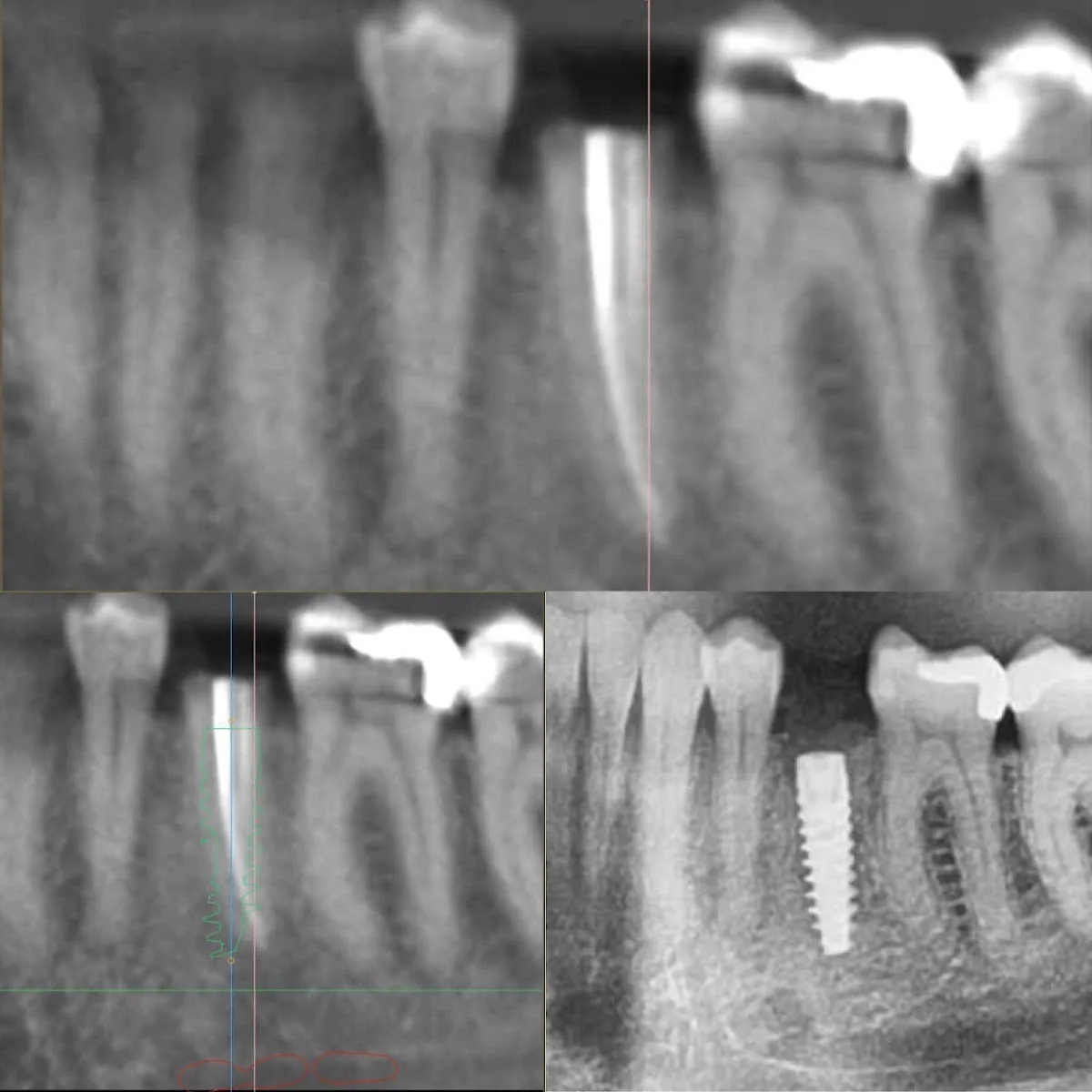 Torrance Oral Surgery Center photo 2