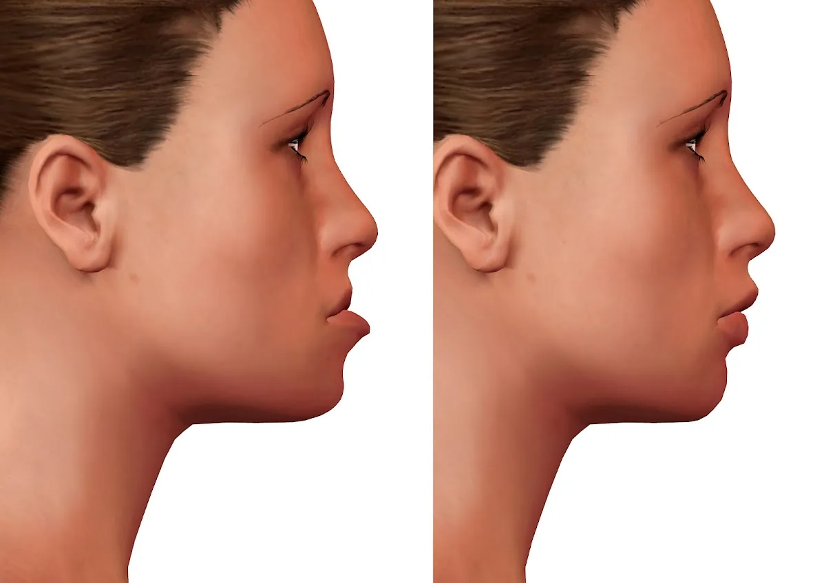 Ventura Jaw Surgery and TMJ photo 1