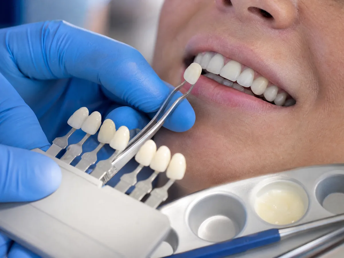 Tooth Extraction Dentist Brooklyn