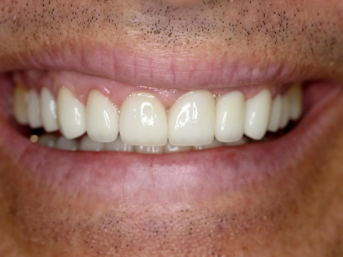 Laredo Dental Care photo 2