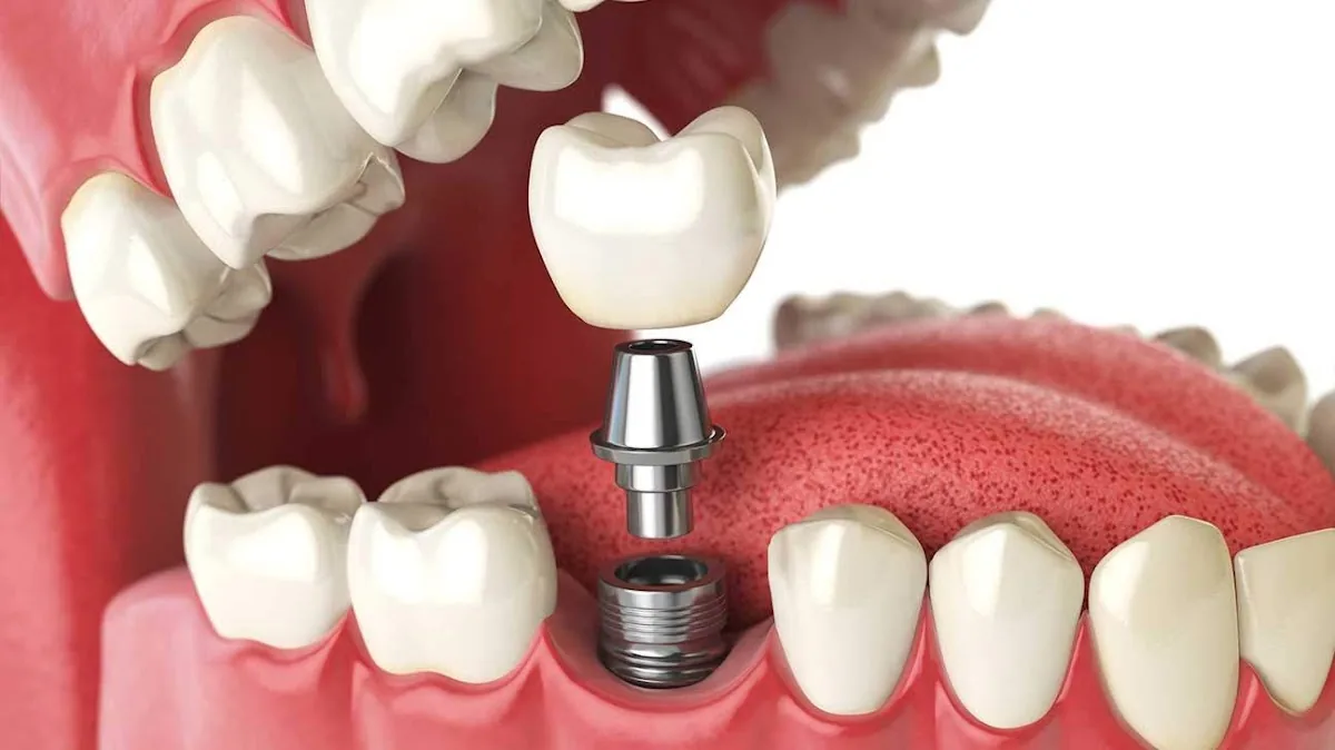 Louisville Oral Surgery & Dental Implants photo 2