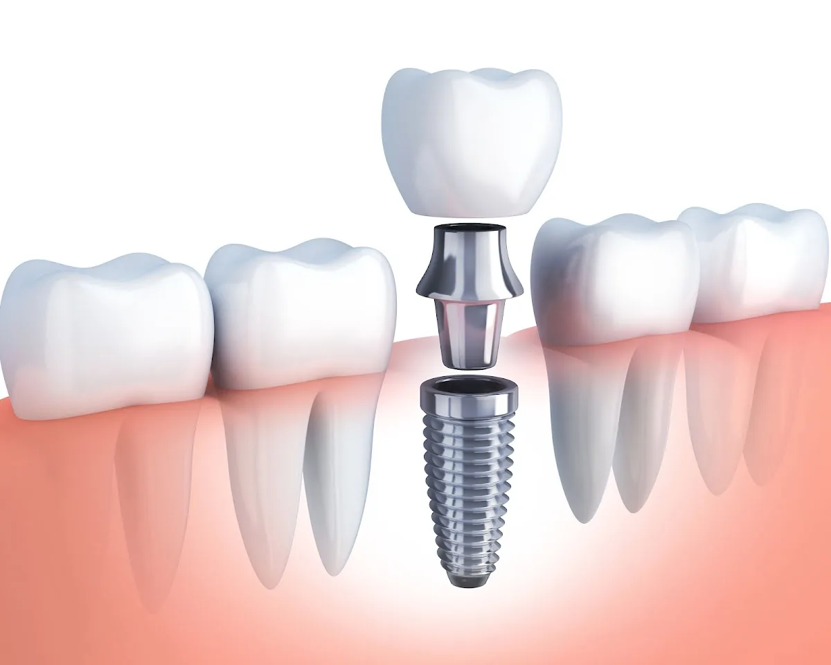 Isidoros Mereos, DDS photo 3
