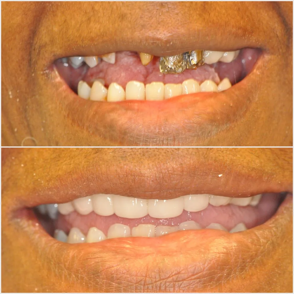 Nashville Cosmetic and Implant Dentistry photo 4