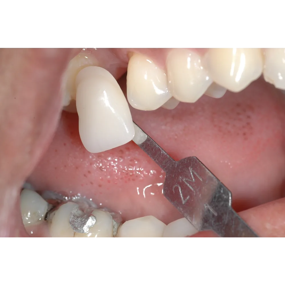 Brite Care Dental photo 5