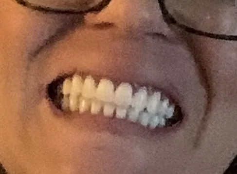 The Smile Center photo 3