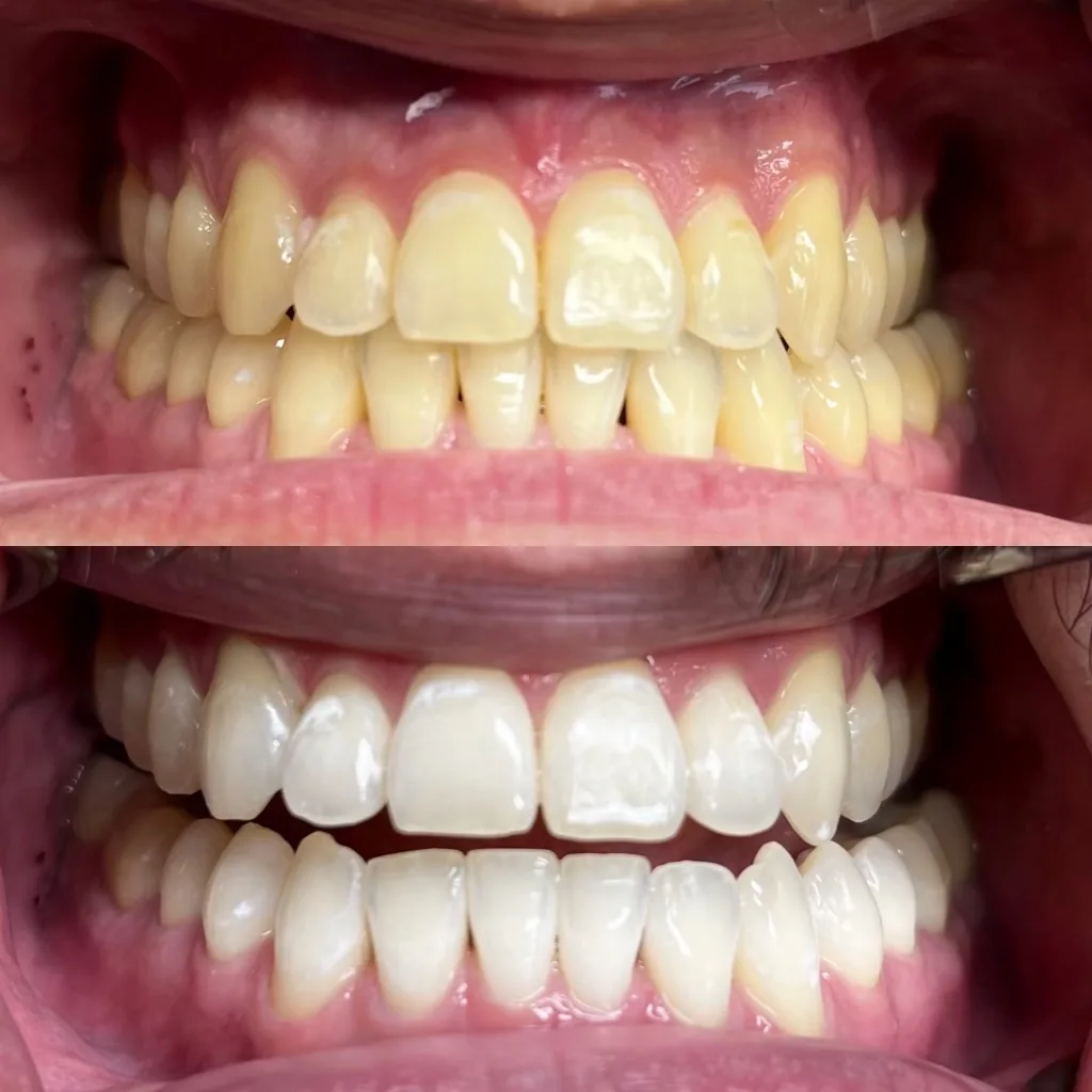 iSmile Dental Group photo 3