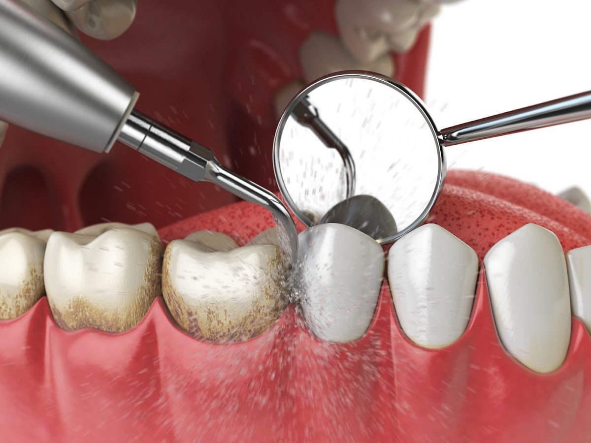 Tooth Time Family Dentistry photo 2