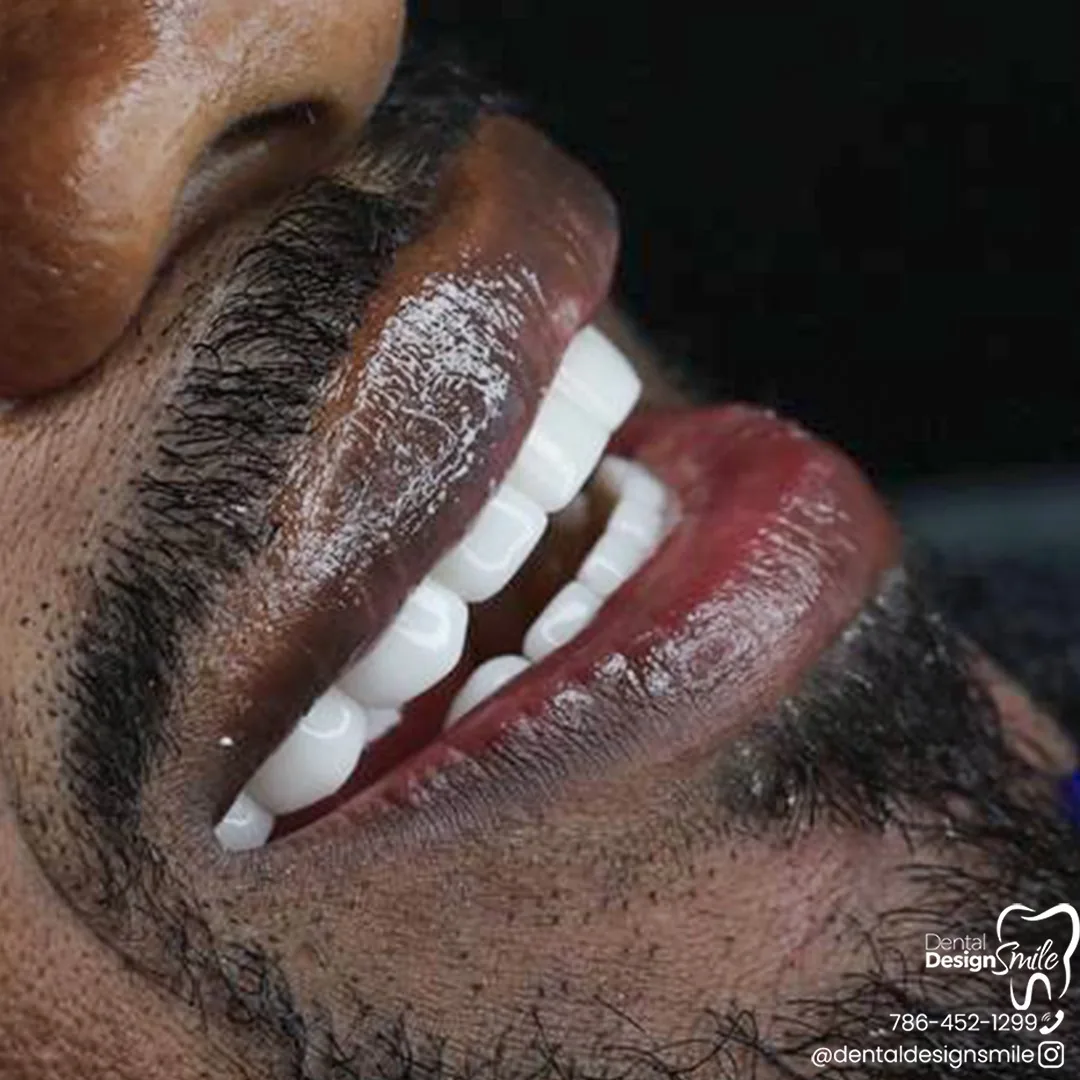 Dental Design Smile photo 2