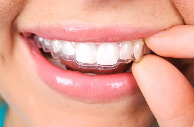 Smile Center Dental photo 5