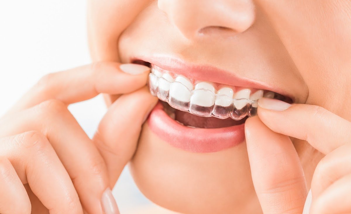 Artista Dental Studio, Dr. Joseph Manfredi DDS photo 2
