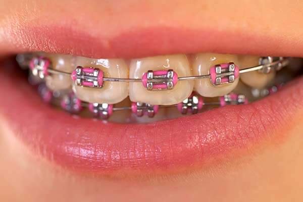 Dental Republic - Bandera, P.C. photo 2