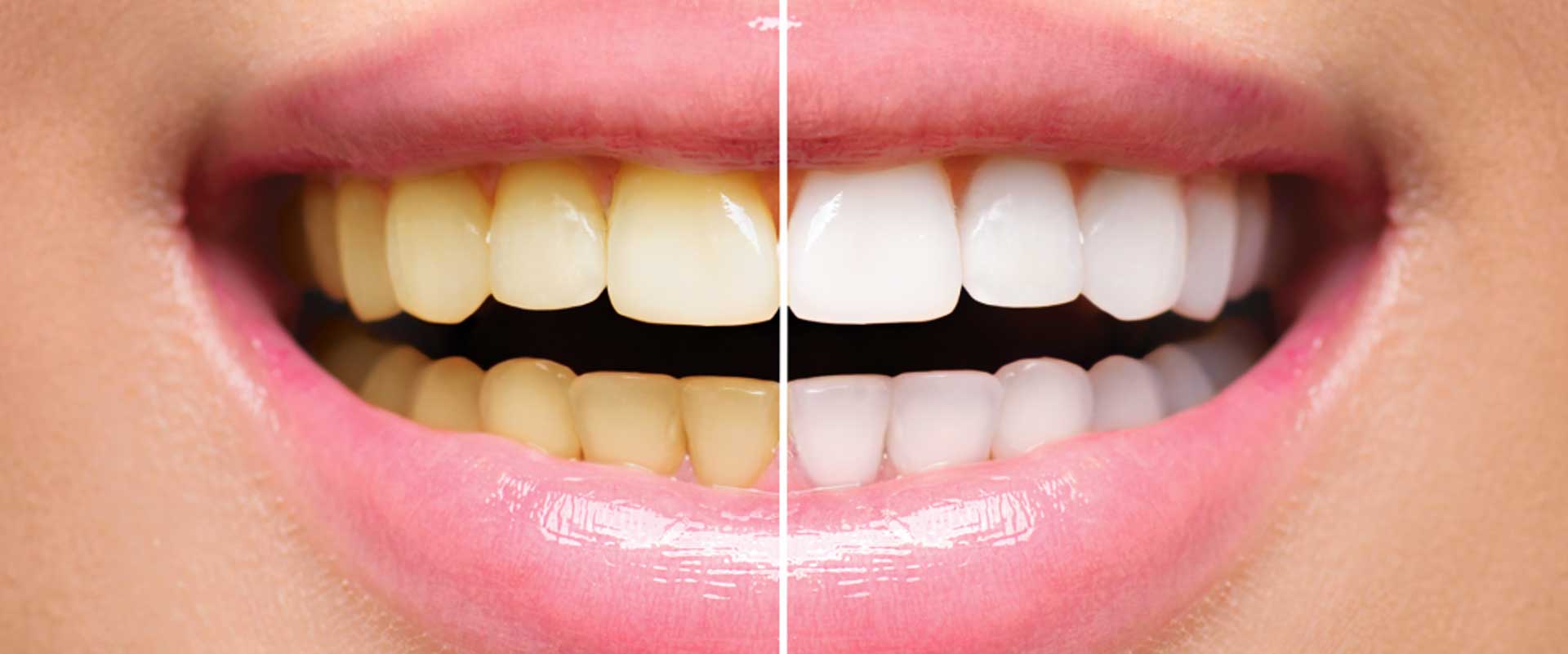 Canberra Dental Care – Dr Zoe Muir