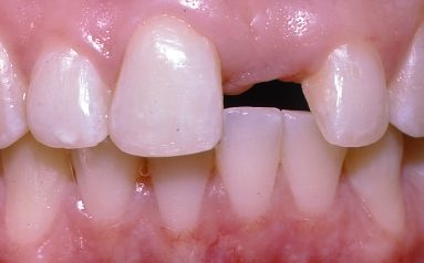 Neal R. Bucholtz, D.D.S.