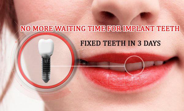 Mysore Dental Care & Implant Center