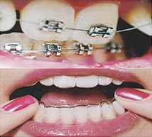 MT A Dental Centre Mount Alvernia (Progressive Dental Specialists Pte Ltd)