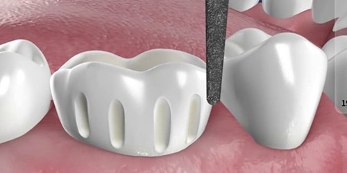 Howick Dental Surgery