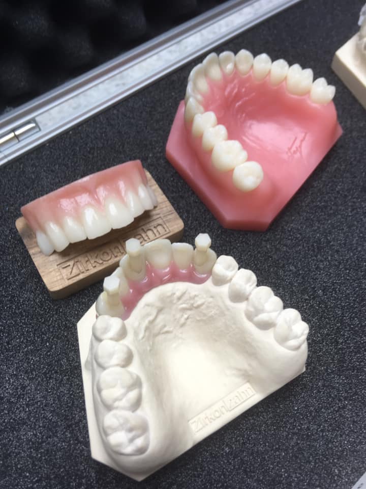 Newquay denture lab