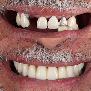 Monument Dental Studio