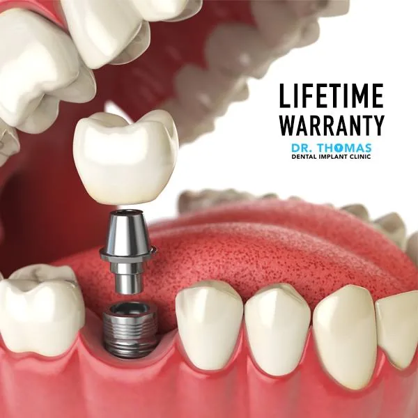 Dr. Thomas Dental Implant Clinic DMCC photo 2