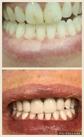 Cosmetic and Family Dentistry of Las Colinas photo 5