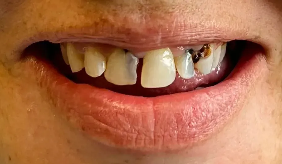 Smile Design Modern Dentistry