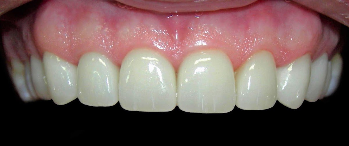 Larchmont Dental Associates photo 6