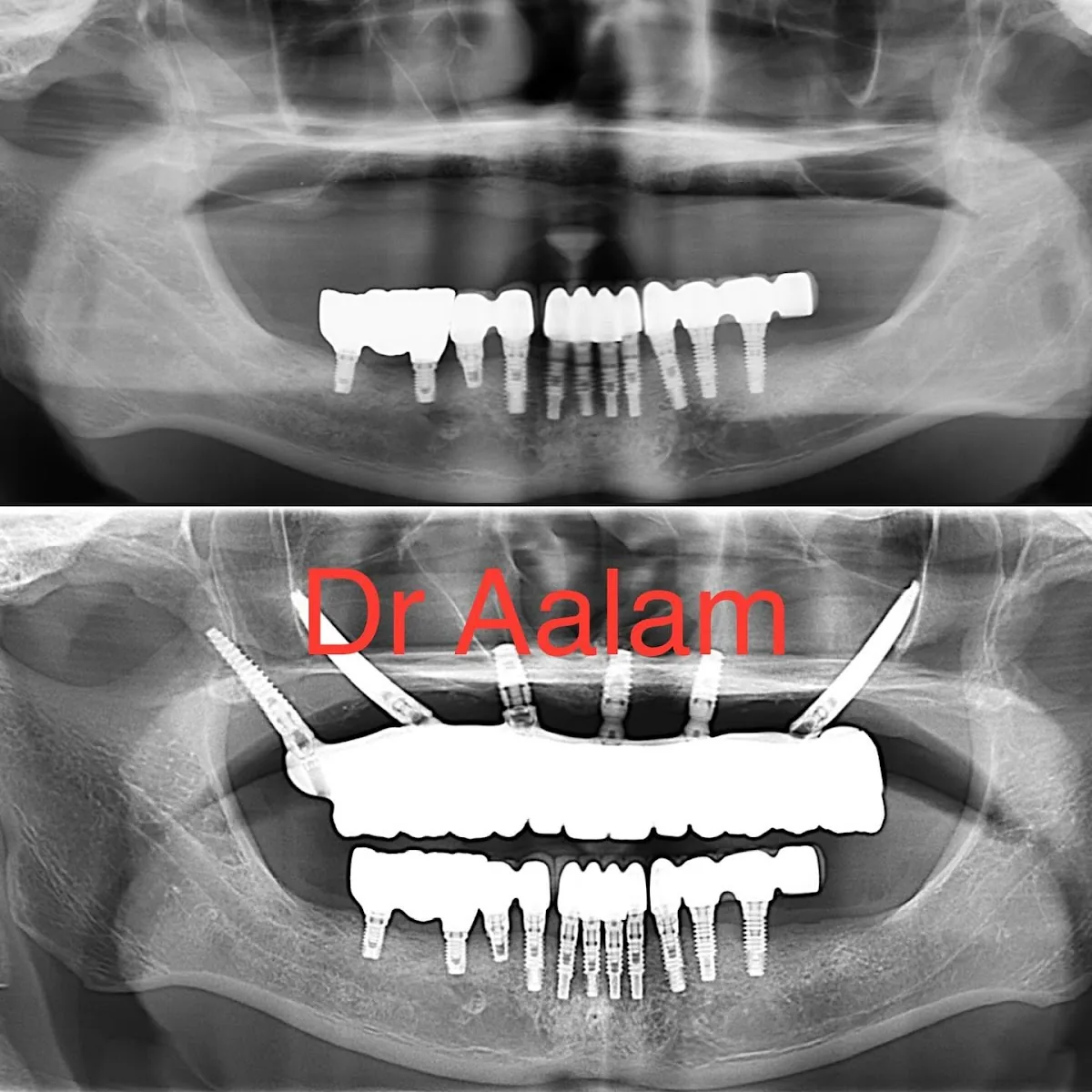 CENTER for Advanced Periodontal & Implant Therapy photo 2